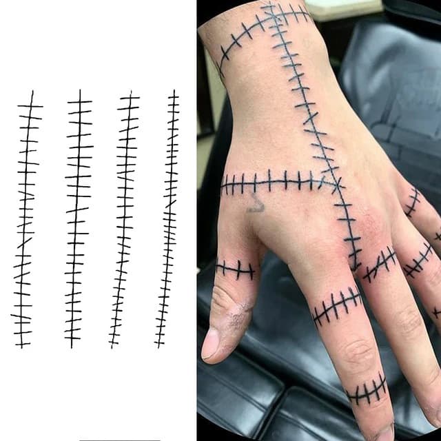 Stitches — view 1